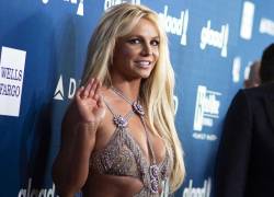 Britney Spears revela que sufrió quemaduras en su rostro tras la explosión de una chimenea