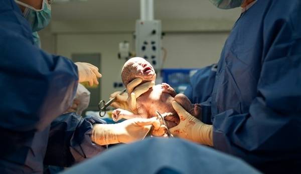 Por Qu Se Sigue Cortando La Vagina De Las Madres Durante El Parto