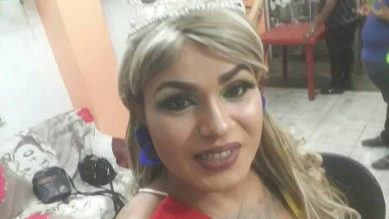 Estilista trans de Babahoyo falleció luego de que le inyectaron una sustancia desconocida en los glúteos