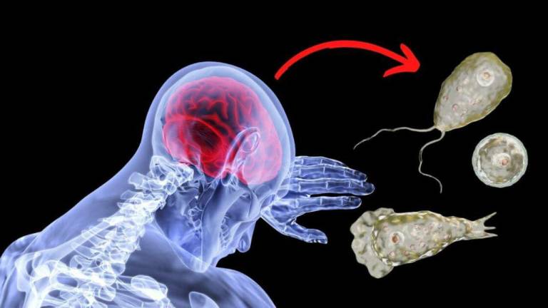 $!Corea del Sur confirma primera muerte por ameba comecerebros. ¿Cómo se contrae y por qué es tan peligrosa?