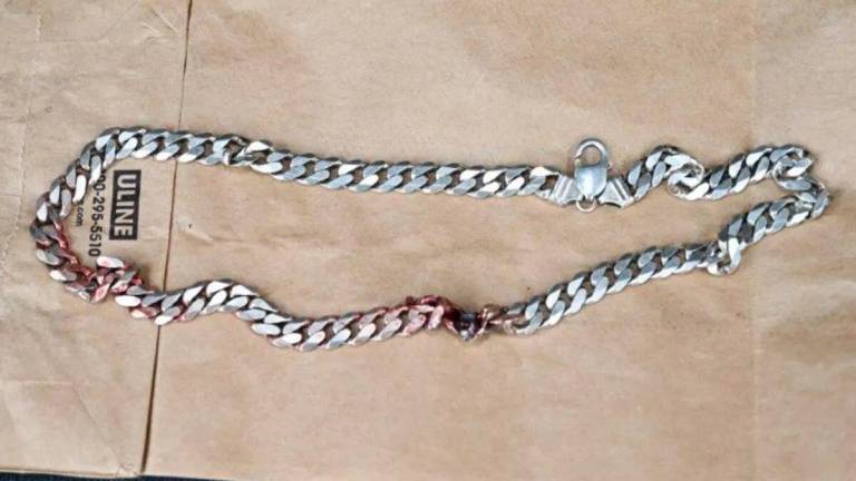 Un collar de metal salvó la vida de un hombre al detener un disparo que iba dirigido a su cuello