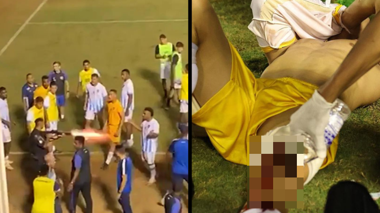 VIDEO | Un futbolista es herido en Brasil por bala de goma disparada por un policía a menos de un metro de distancia