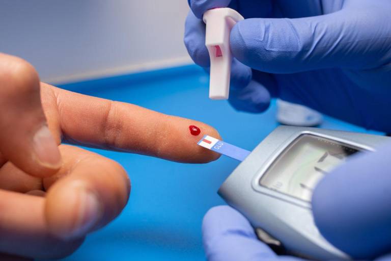 $!Los elevados niveles de azúcar en la sangre de las personas con diabetes causan daño en los nervios y mala circulación.