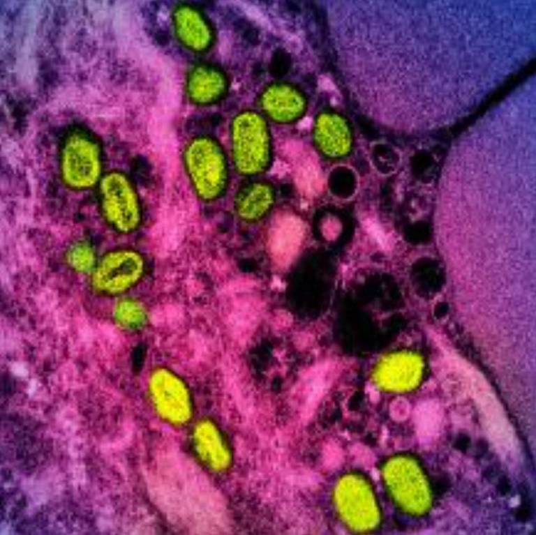 $!Esta imagen sin fecha obtenida del Instituto Nacional de Alergias y Enfermedades Infecciosas en Bethesda, Maryland, muestra una micrografía electrónica de transmisión coloreada de partículas de viruela simica (verde) encontradas dentro de una célula infectada (rosa y violeta), cultivadas en el laboratorio.